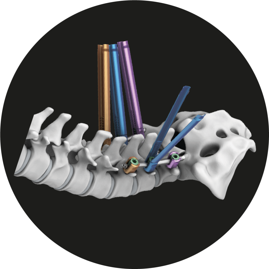 Zenius Mis (Medyssey) Minimally Invasive Spinal Fixation System