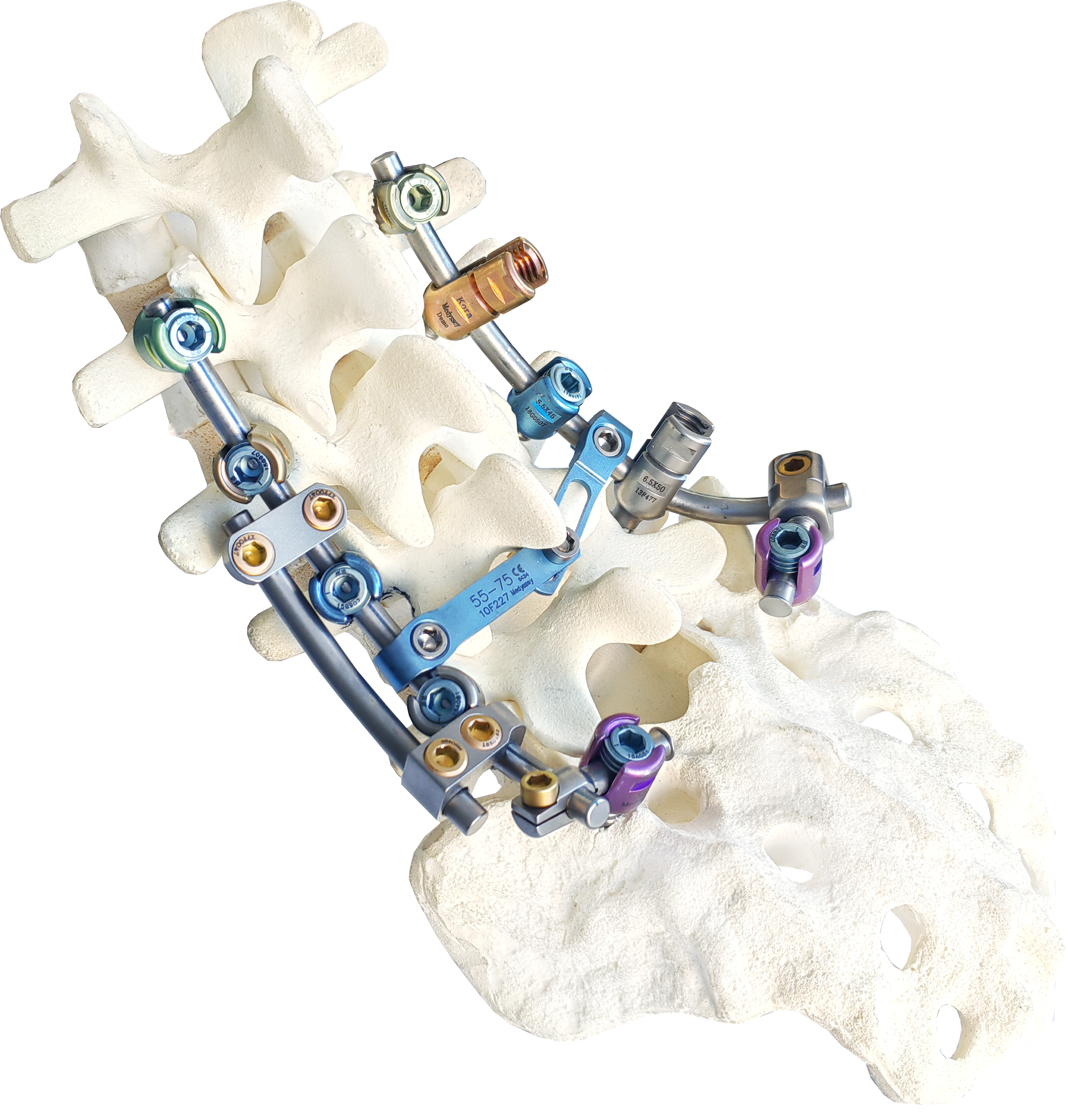 KORA (Medyssey) spinal fixation system provides the simplest and comprehensive stabilization solutions for spinal fixation.